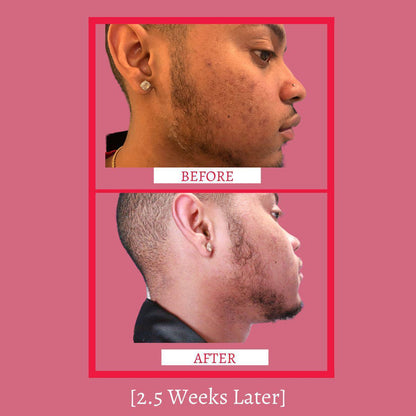 Mini Set - Travel Size - Glass Skin Set