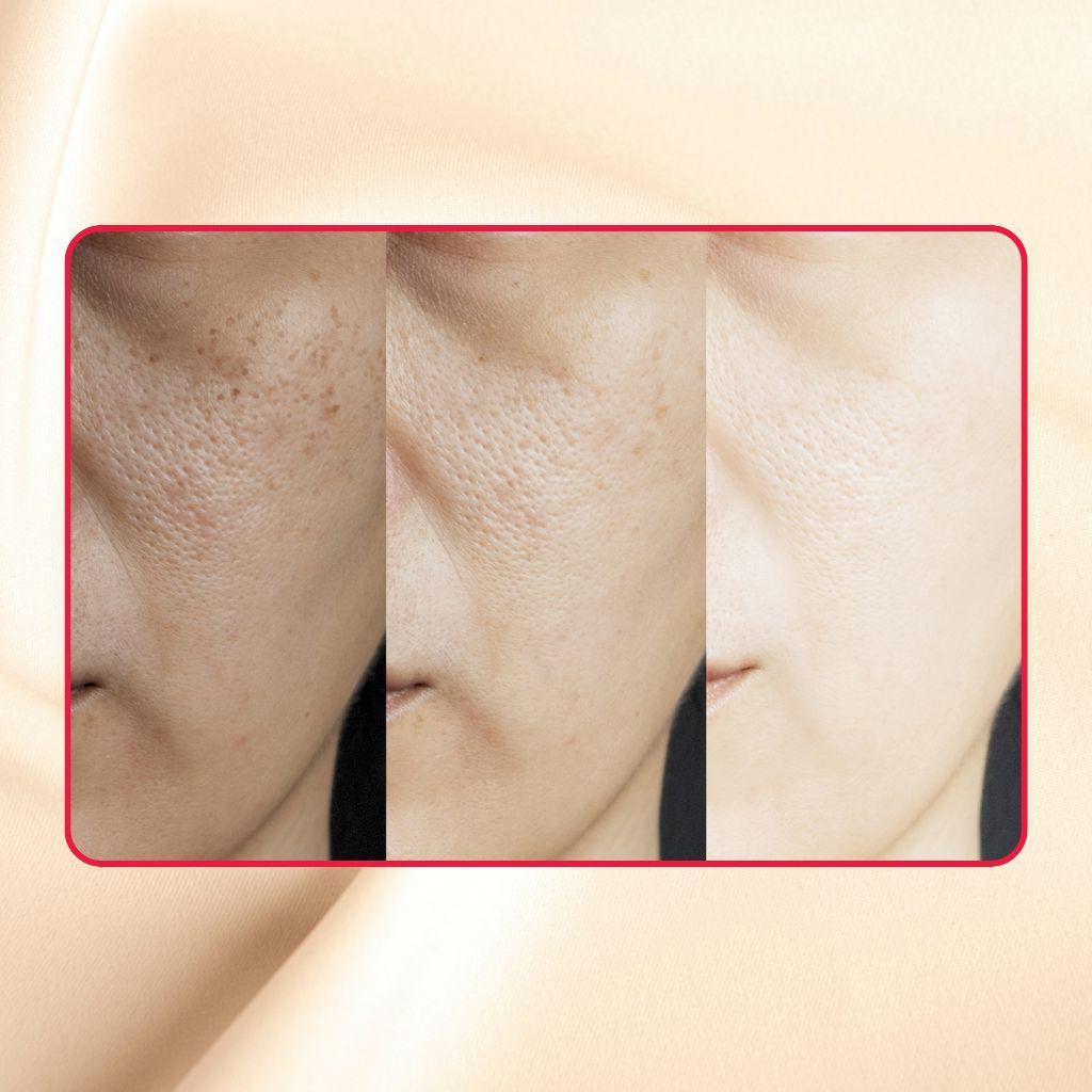 Thick As Thieves Pure Glycolic Acid Lactic Acid Extreme Gel Peel - 30ml