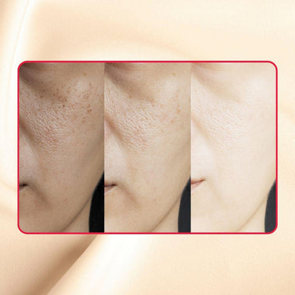 Thick As Thieves Pure Glycolic Acid Lactic Acid Extreme Gel Peel - 30ml