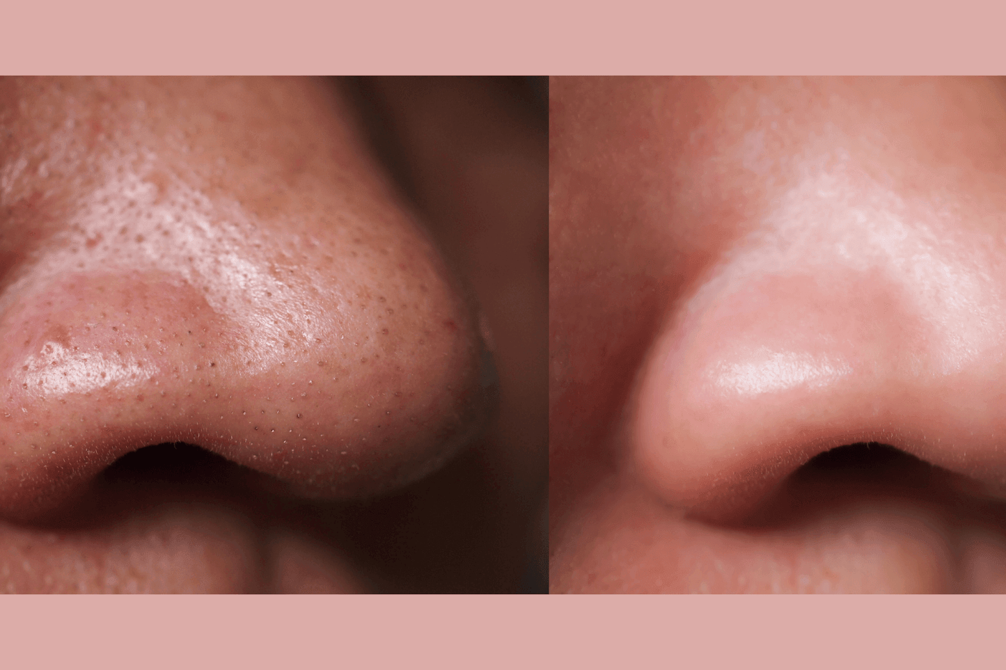 Ultra-Advanced Anti-Aging Daily Resurfacing Pads