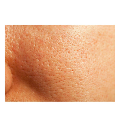 Thick As Thieves Pure Glycolic Acid Lactic Acid Extreme Gel Peel - 30ml