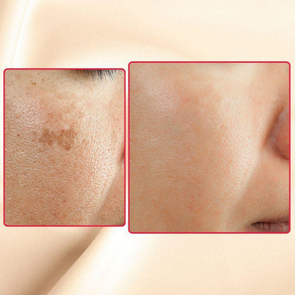 The Eraser Spot Cream | Dark Spot Corrector