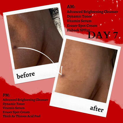 The Eraser Spot Cream | Dark Spot Corrector