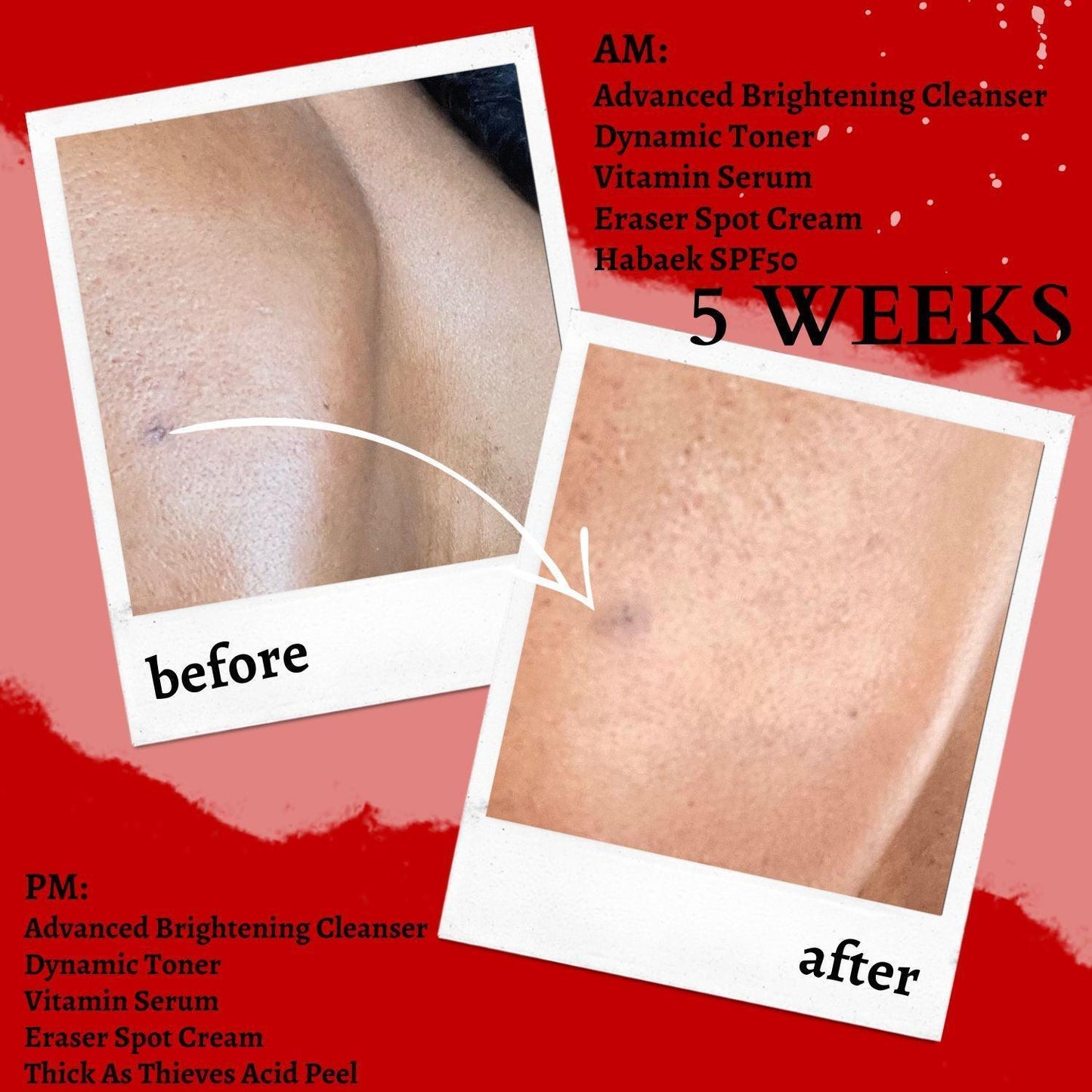 The Eraser Spot Cream | Dark Spot Corrector